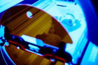 fenykezeles-es-vitiligo