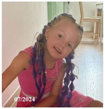 Vitiligo u deti liecba