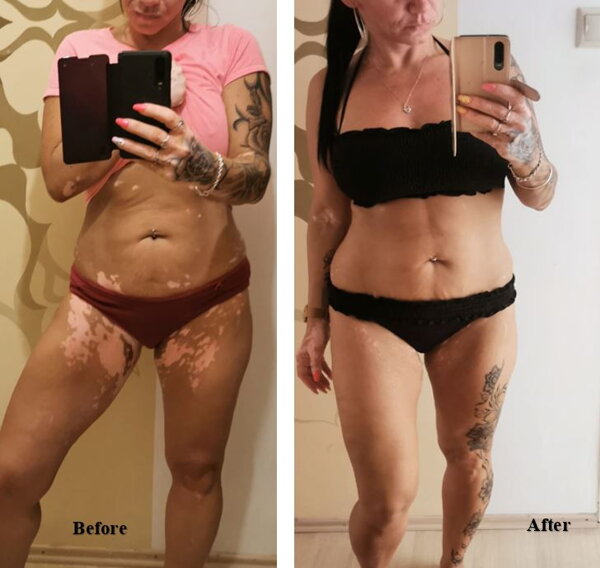 Vitistop tablets review