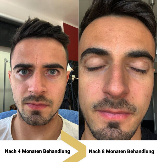 Vitistop-Tabletten Ergebnisse