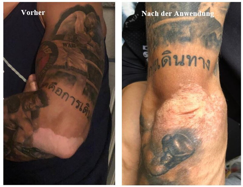 Vitistop-Gel Ergebnis